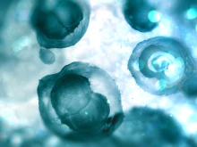 Human embryos.