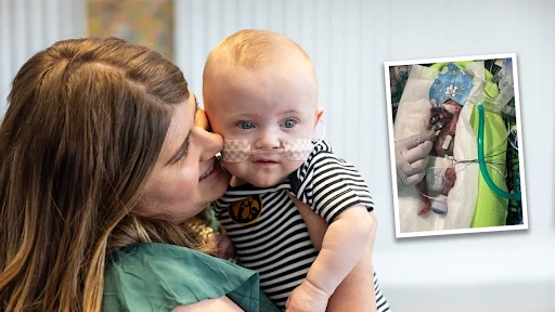 Mollie Keen and her baby, Nash, the world’s youngest premature baby. Nash was born more than four months early and celebrated his first birthday this month.?w=200&h=150