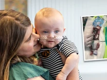 Mollie Keen and her baby, Nash, the world’s youngest premature baby. Nash was born more than four months early and celebrated his first birthday this month.